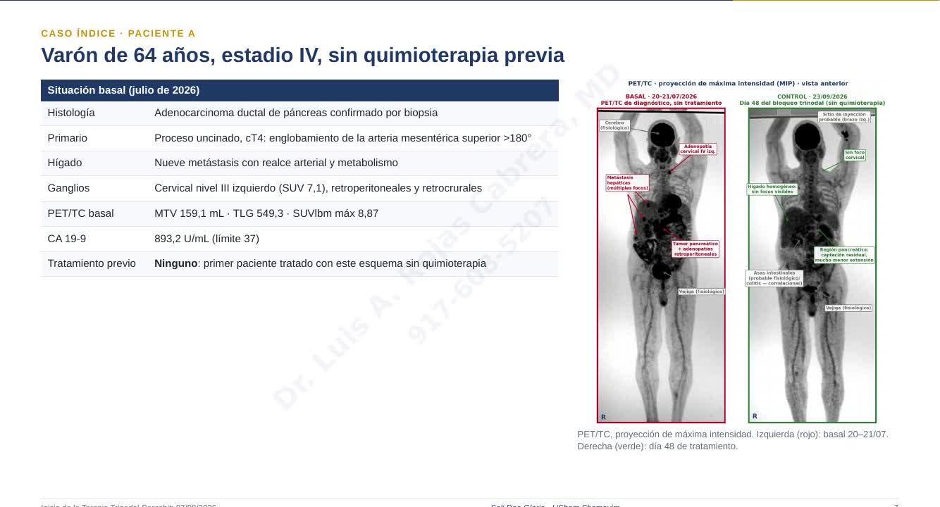 Situación basal del paciente A: adenocarcinoma ductal de páncreas estadio IV y comparación PET/TC de máxima intensidad