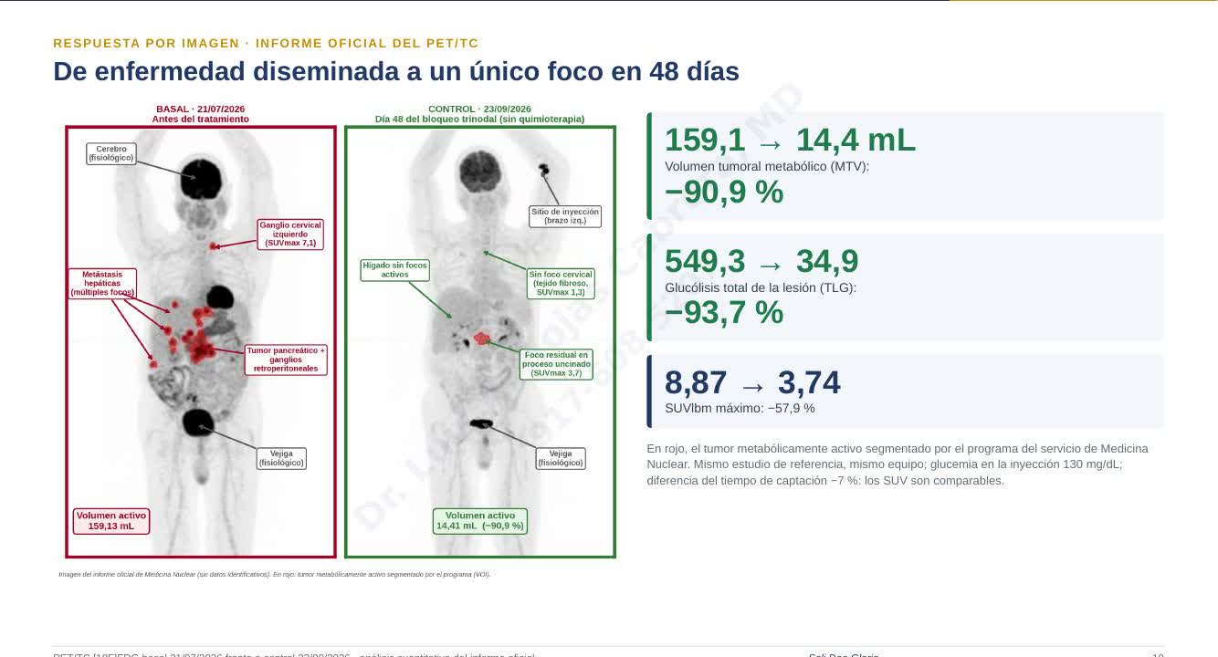 PET/TC del caso índice: comparación basal (21/07/2026) frente al día 48 de tratamiento (23/09/2026), con reducción del volumen tumoral metabólico del 90,9%